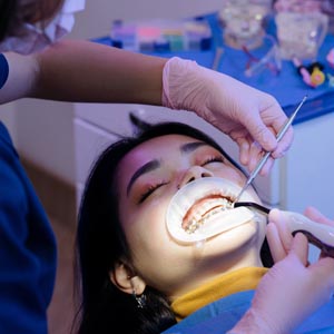 5 Reasons You Need to Visit Emergency Dentist