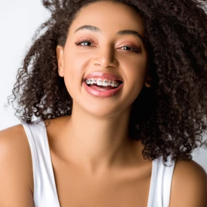 Smiling young woman wearing dental braces in Edison, showing straightening progress with clear metal brackets.