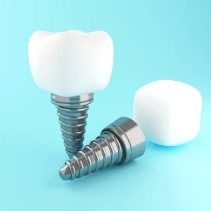 Close-up illustration of dental implants in Edison with titanium screw and ceramic crown.