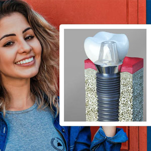 Emergency Dental Implants: How to Get the Care? | Edison Emergency Dental Implants: How to Get the Care? | Edison